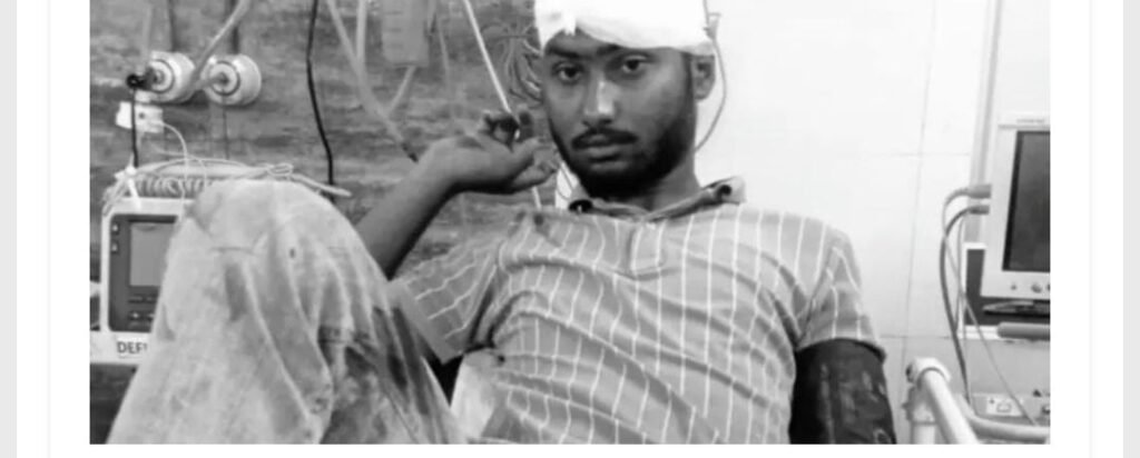 आदित्यपुर में पुलिस की दबिश के बाद युवक पर फायरिंग, मुखबिरी के शक में सिर को छूकर निकली गोली